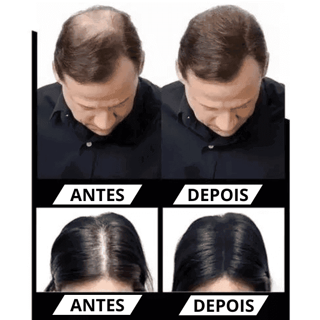 Pó Em Fibra De Queratina - Anti-Calvície - HairFiber Sevích™