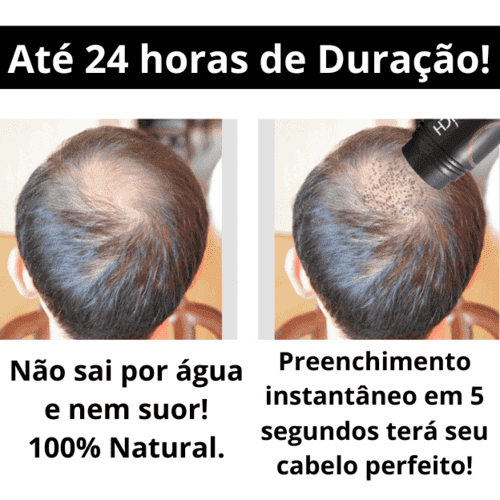 Pó Em Fibra De Queratina - Anti-Calvície - HairFiber Sevích™